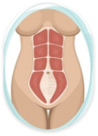 diastasis-above-umbilicus-treatment