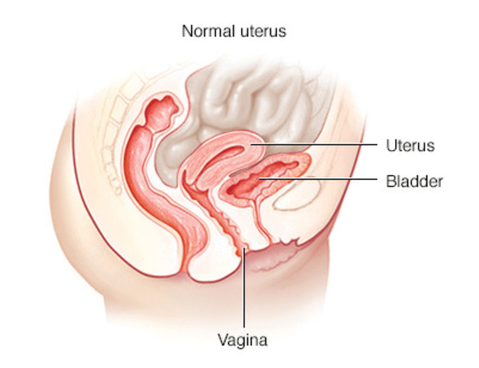 Pelvic Floor Dysfunction Normal Uterus